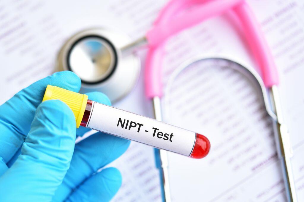 בדיקת NIPT